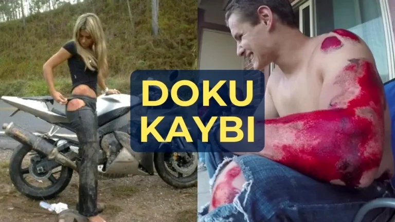 motosiklet-DOKU-KAYBI-kapak